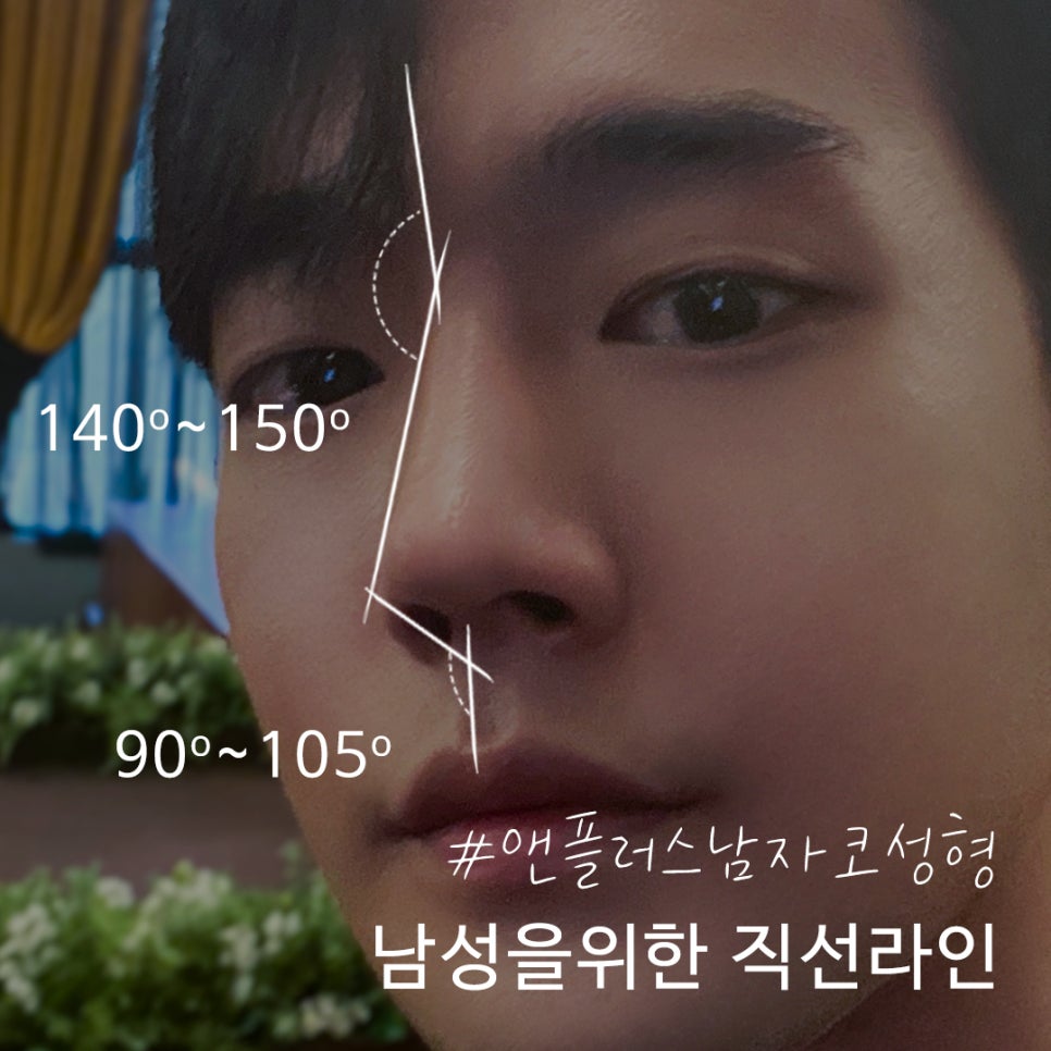 남자코성형전후 남자다운 직선라인으로 관련 이미지 10