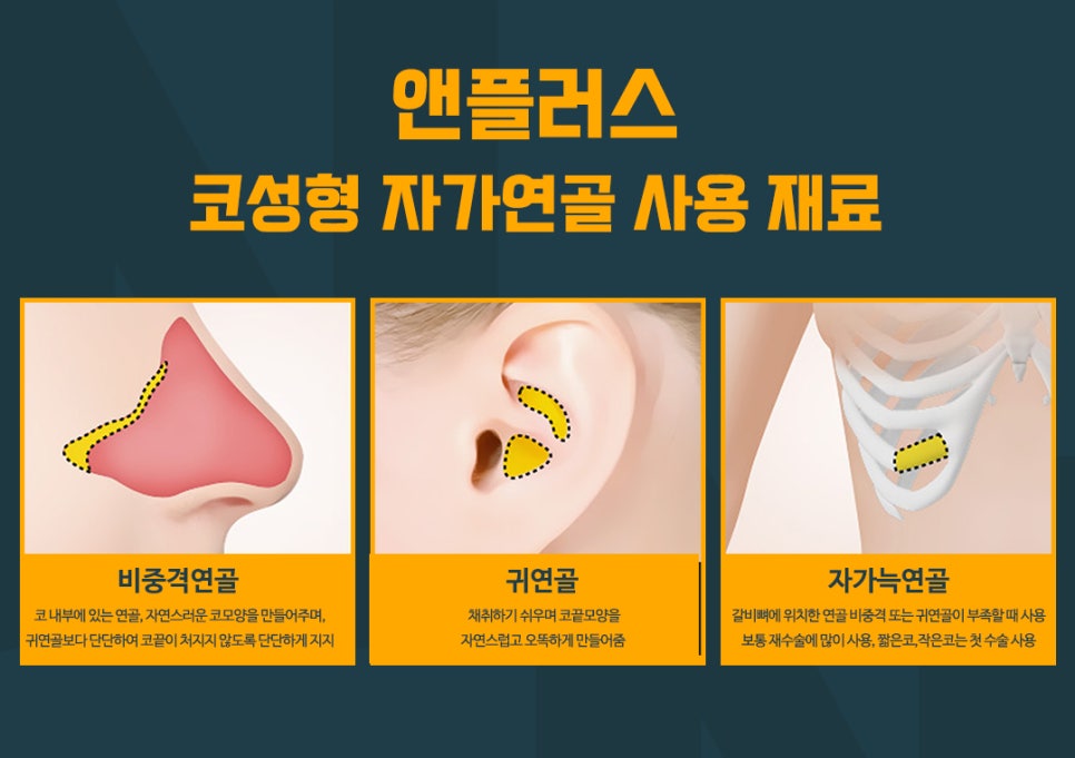 코성형,첫 수술부터 갈비뼈(자가늑연골)로 이식해야 하는 이유 관련 이미지 2