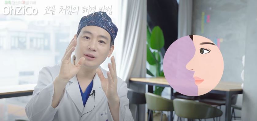 코성형 후 코끝처짐 원인과 해결 방법 관련 이미지 15