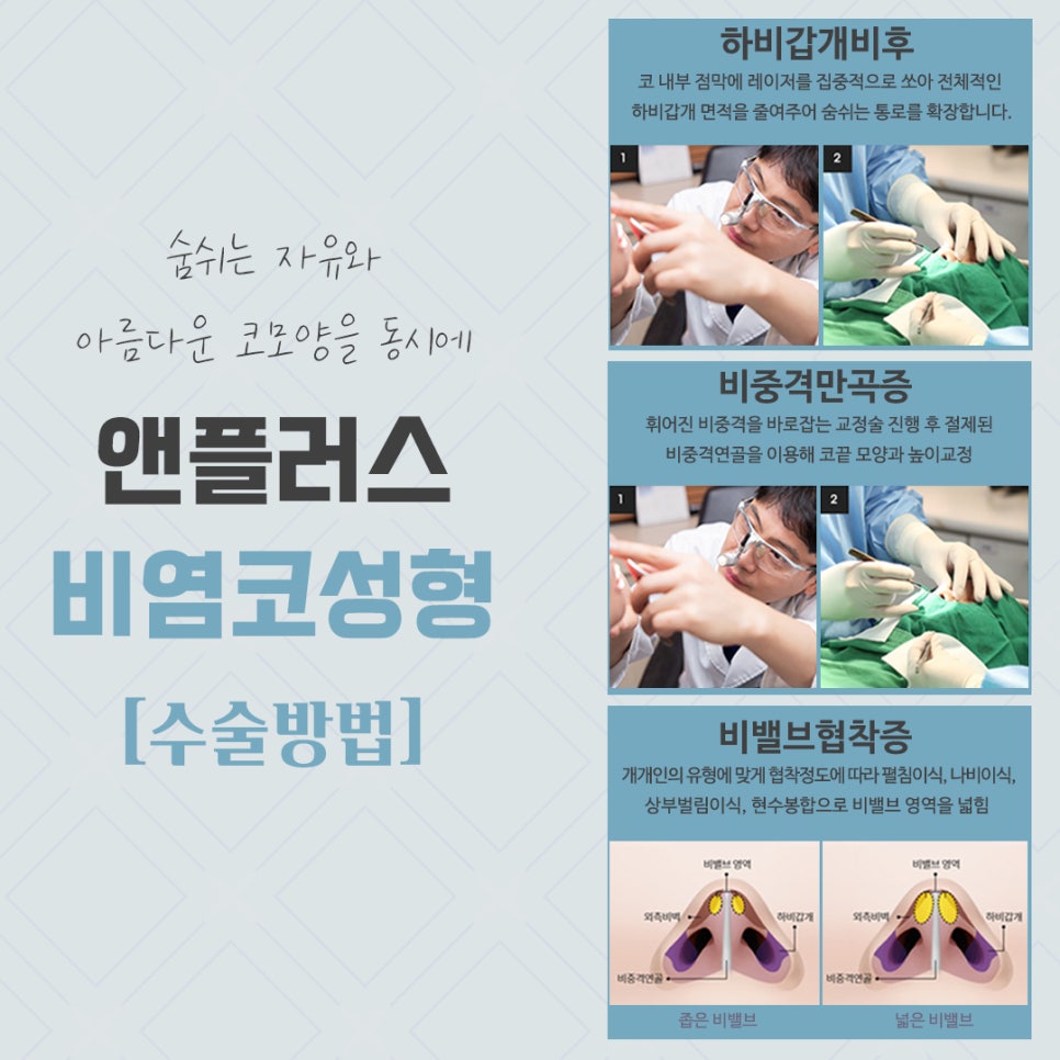 비염코성형후기 원인을 자세하게 알아보고 관련 이미지 7