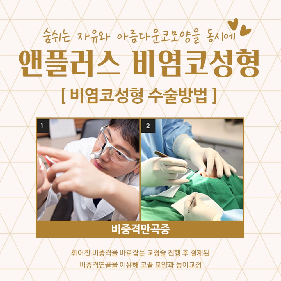 비염코성형후기 예쁜코라인을 생각하면서 관련 이미지 11