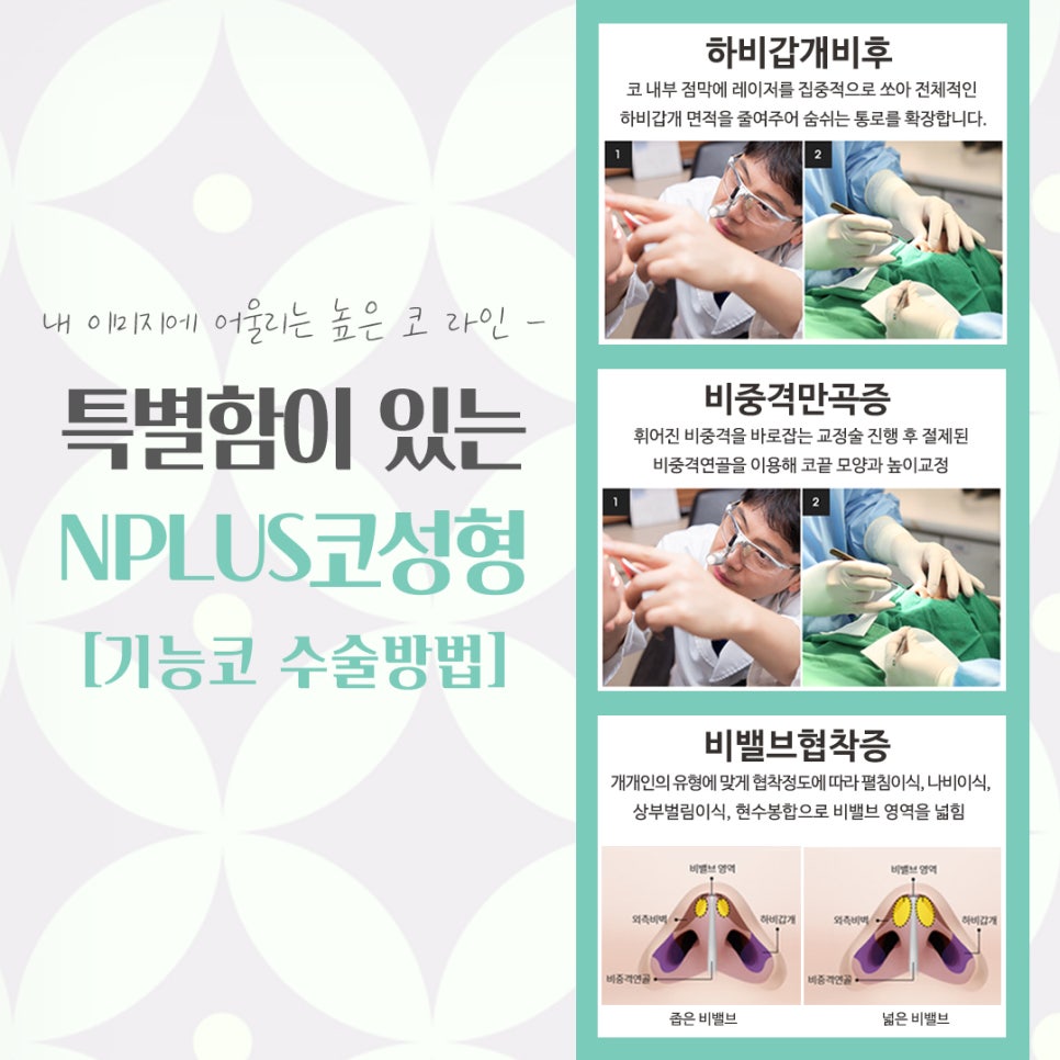 코성형잘하는곳에 대해 비교해 보고 관련 이미지 9