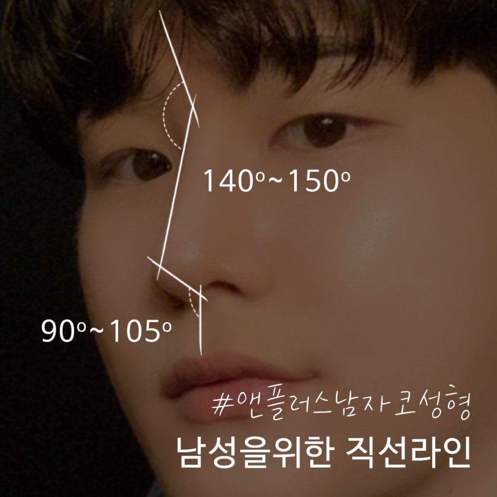 남자코성형후기 기능까지 추가하여 관련 이미지 3