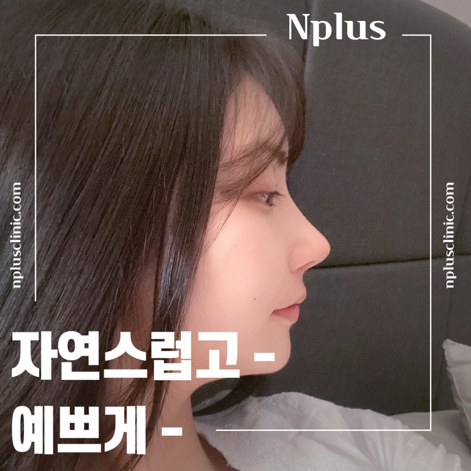 매부리코수술후기 예쁜코라인으로 관련 이미지 2