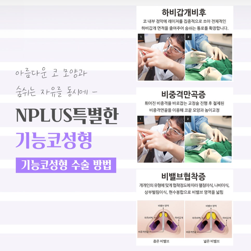 기능코성형후기 꼼꼼하게 체크하고 관련 이미지 9