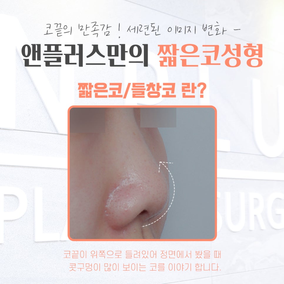 짧은코성형에 대한 차이를 알아보고 관련 이미지 4