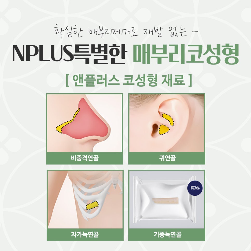 Hump Nose Surgery Review: Check Carefully image 11