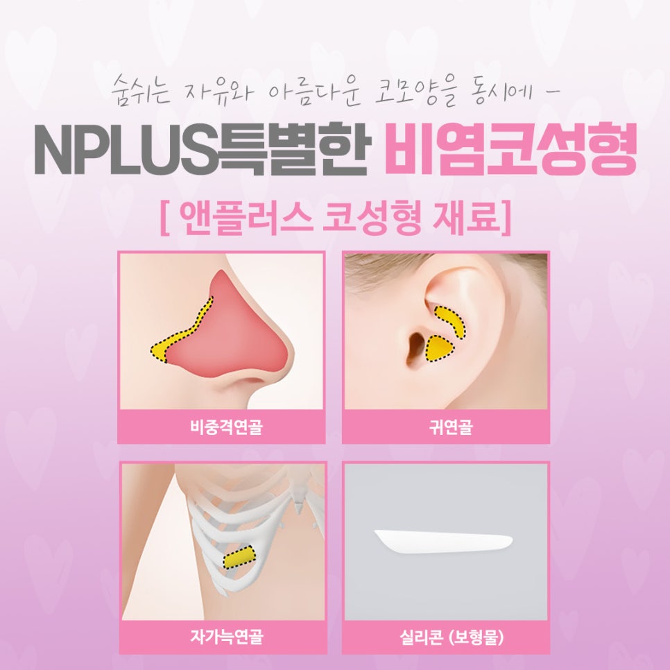 Learn in Detail About Rhinoplasty for Rhinitis image 9