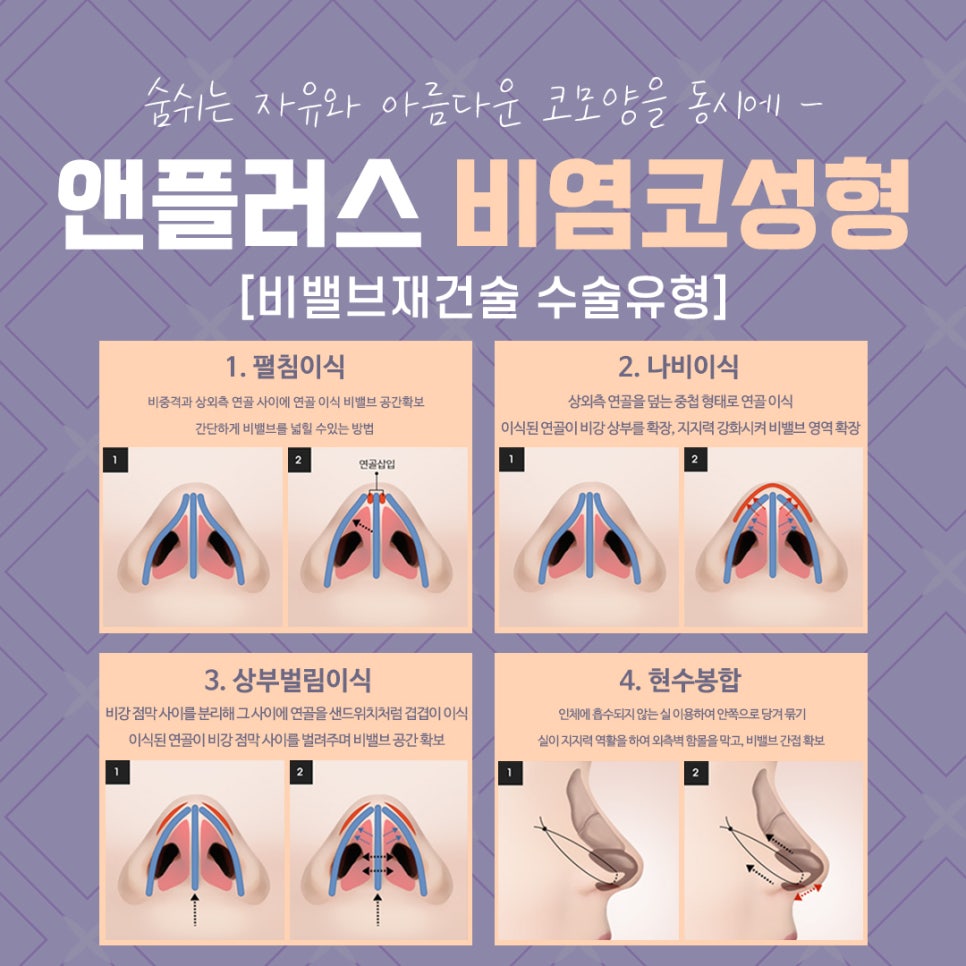 Looking Into Rhinitis Rhinoplasty Reviews and Benefits image 9