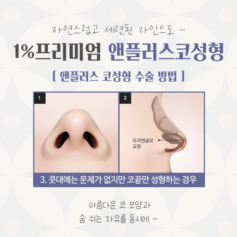 자가늑연골코성형으로 자연스럽지만 화려한 코 라인! 관련 이미지 9