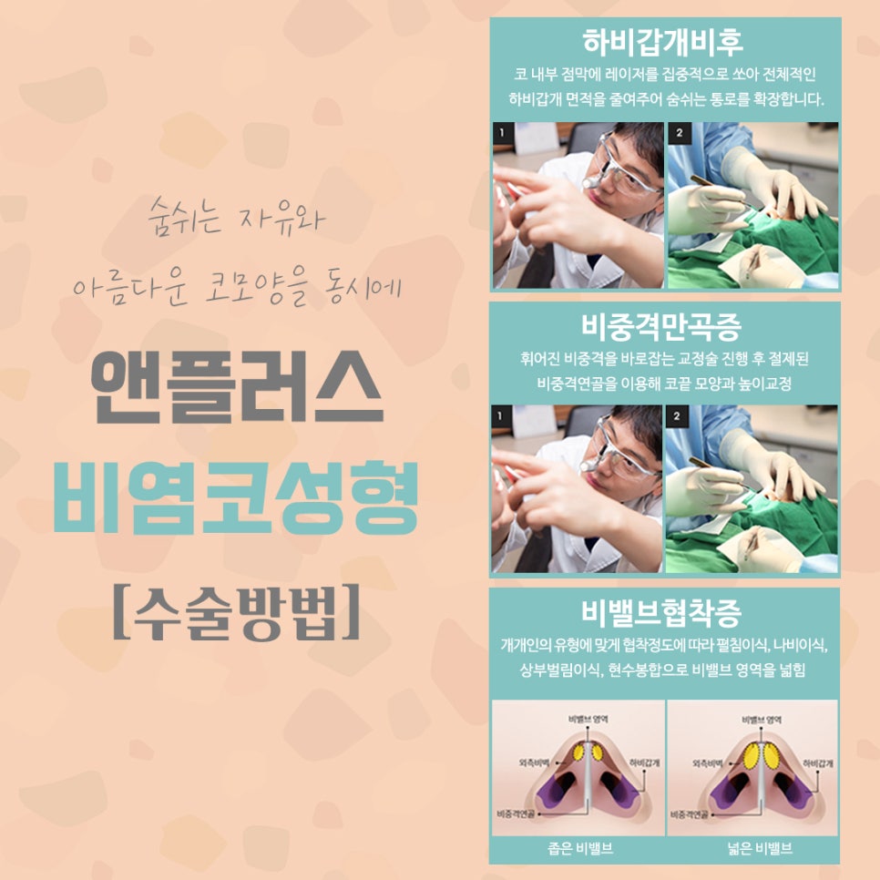 오지코에서 알려드리는 비염코수술 관련 이미지 8