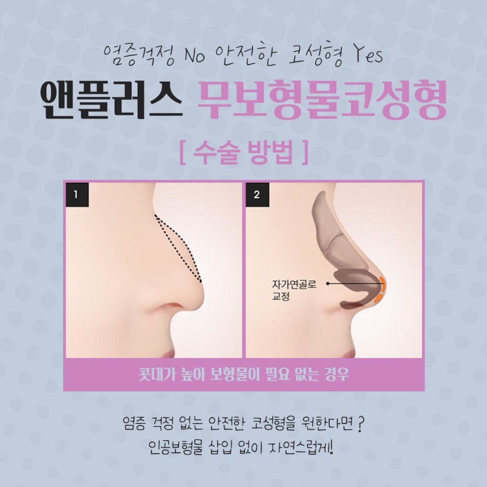 Deciding After Carefully Reviewing Non-Implant Rhinoplasty Reviews image 11