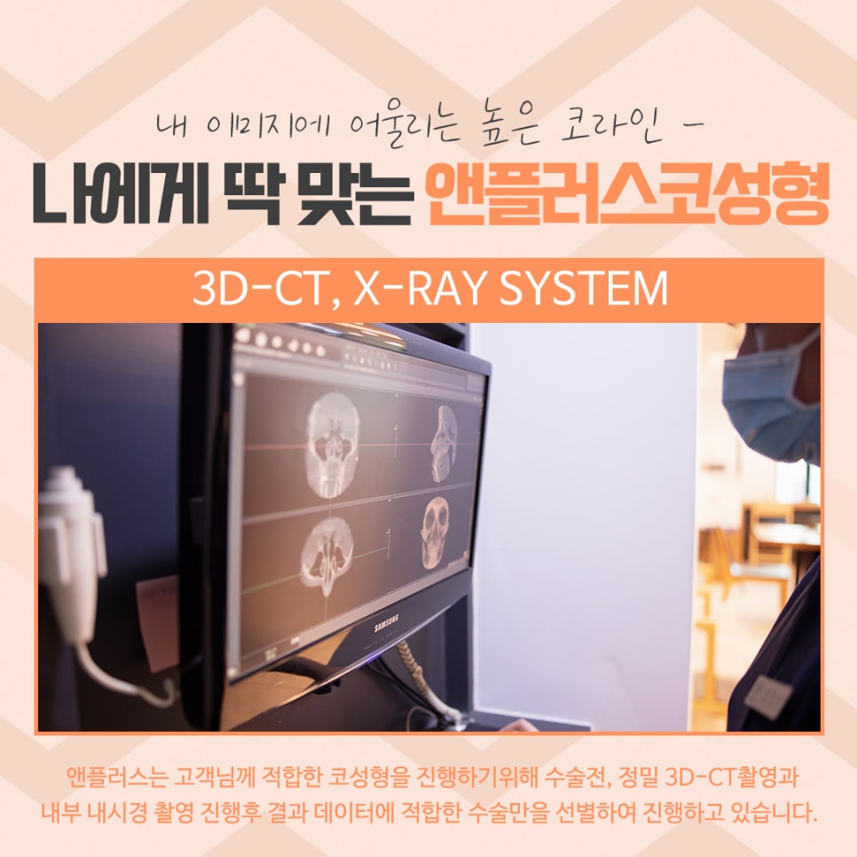코성형 후기로 알아보고 결정 관련 이미지 7