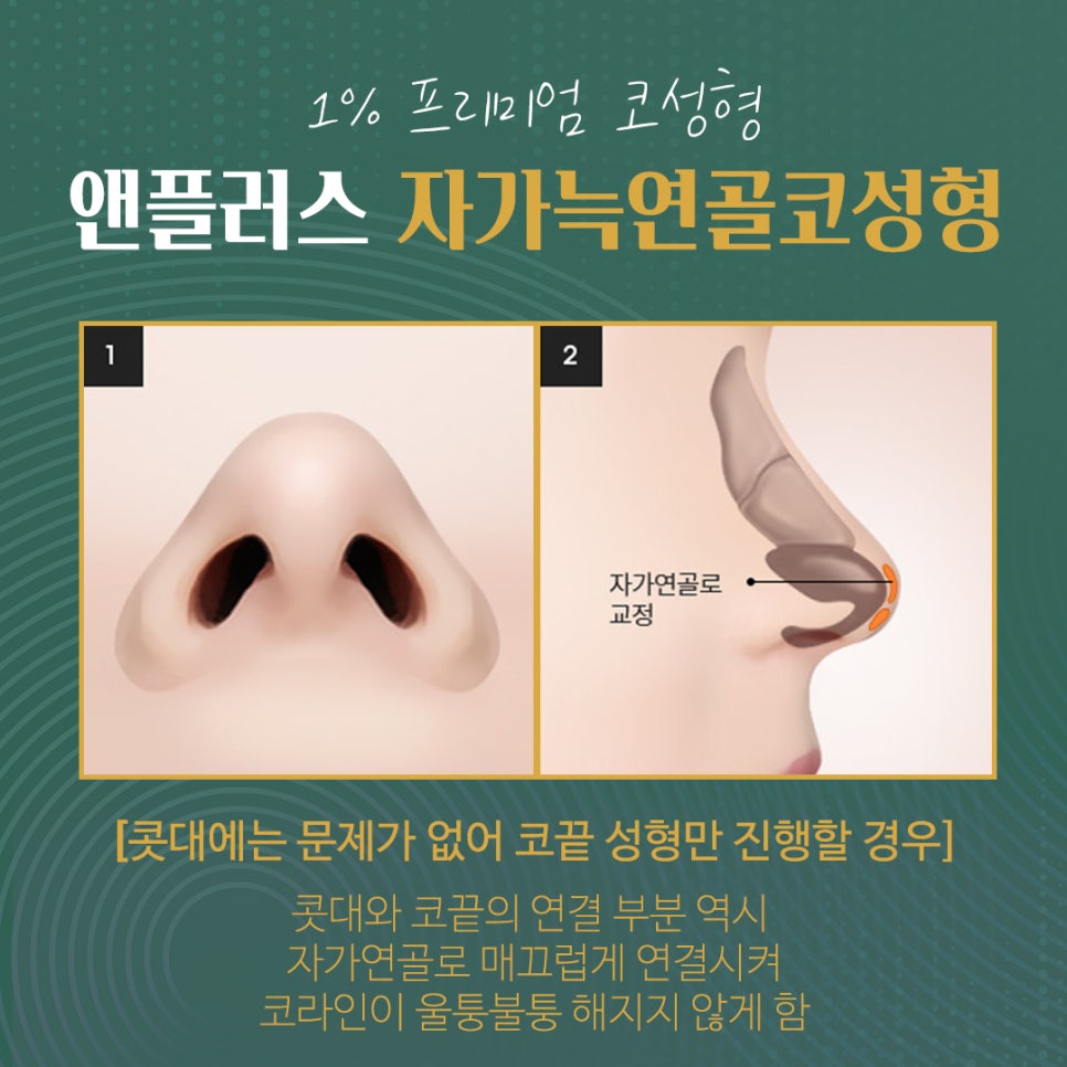 자가늑연골코수술로 처음부터 확실하게 관련 이미지 5