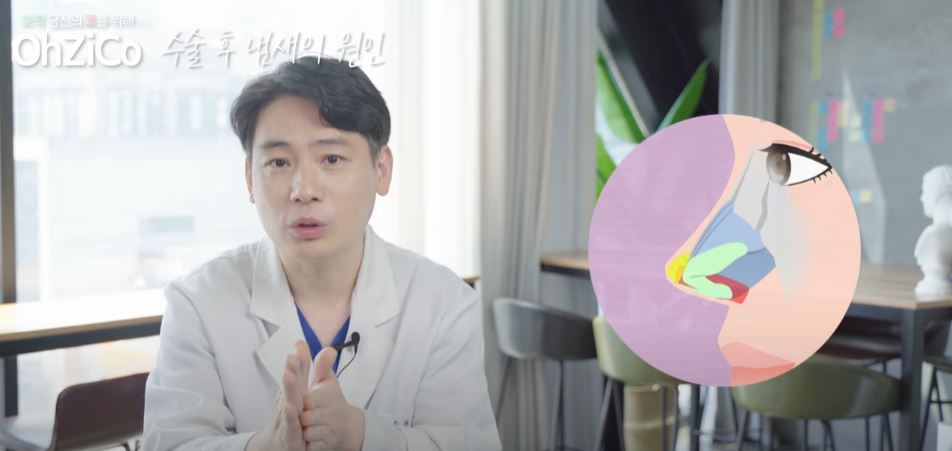 코수술 후 코냄새 원인과 해결 방법! 관련 이미지 10
