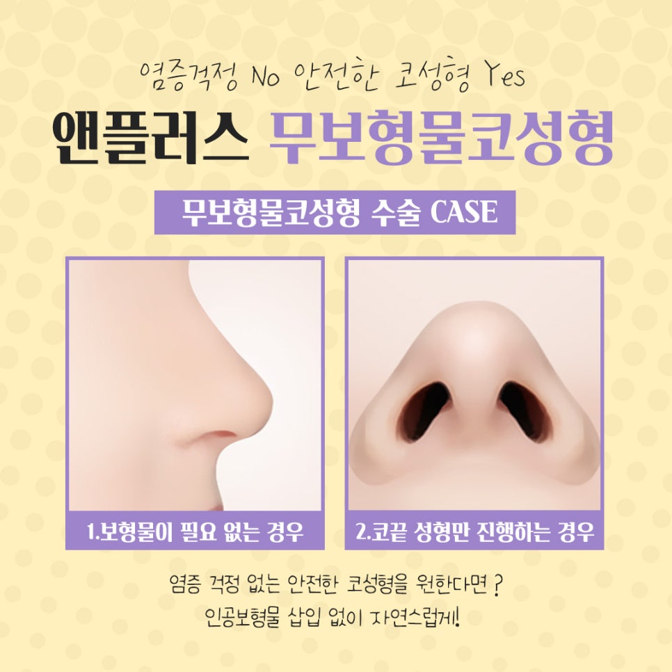 The Importance of Choosing Implant-Free Rhinoplasty image 7