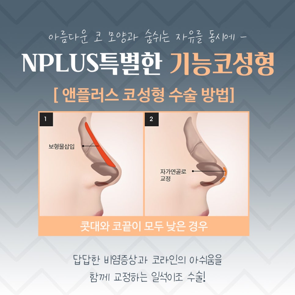 If You Are Looking in Detail at Functional Nose Surgery Before and After image 10