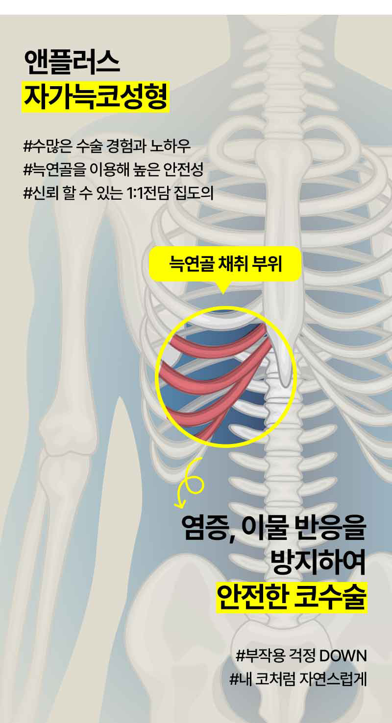 앤플러스 자가늑코성형은 예쁘다! 관련 이미지 4