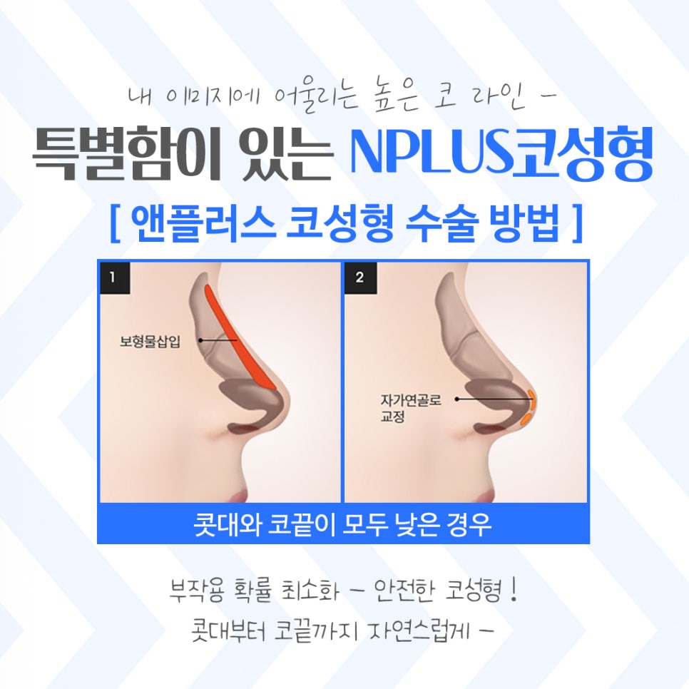 Learn More at a Place Known for Rhinoplasty image 8