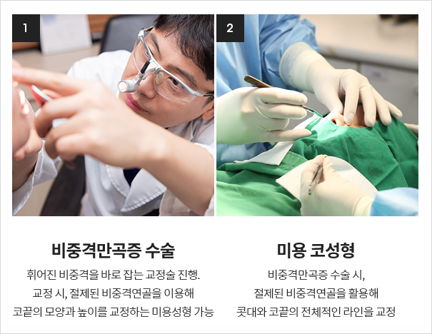 기능코성형 실비 어떤 경우에 받을 수 있는지? 관련 이미지 7
