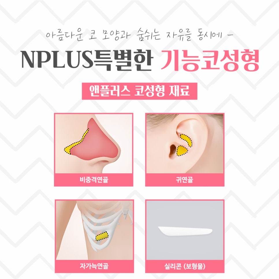 기능코성형후기 원인 파악을 확실하게 관련 이미지 11