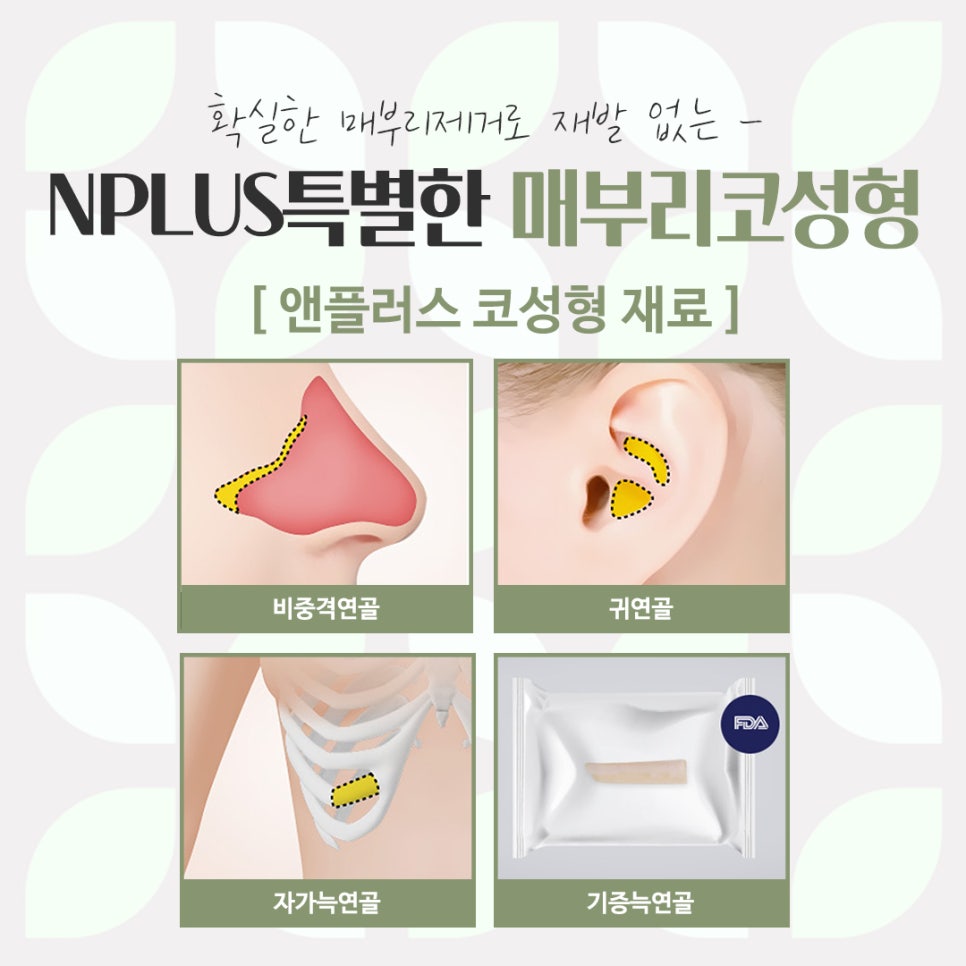Detailed Hump Nose Surgery Review image 13