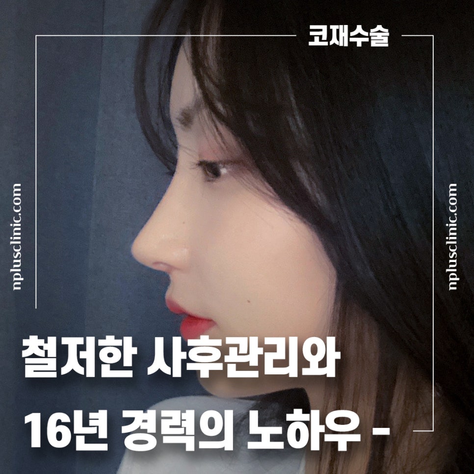 앤플러스에서 알려드리는 성형외과 가을 코수술 이벤트&hearts; 관련 이미지 8