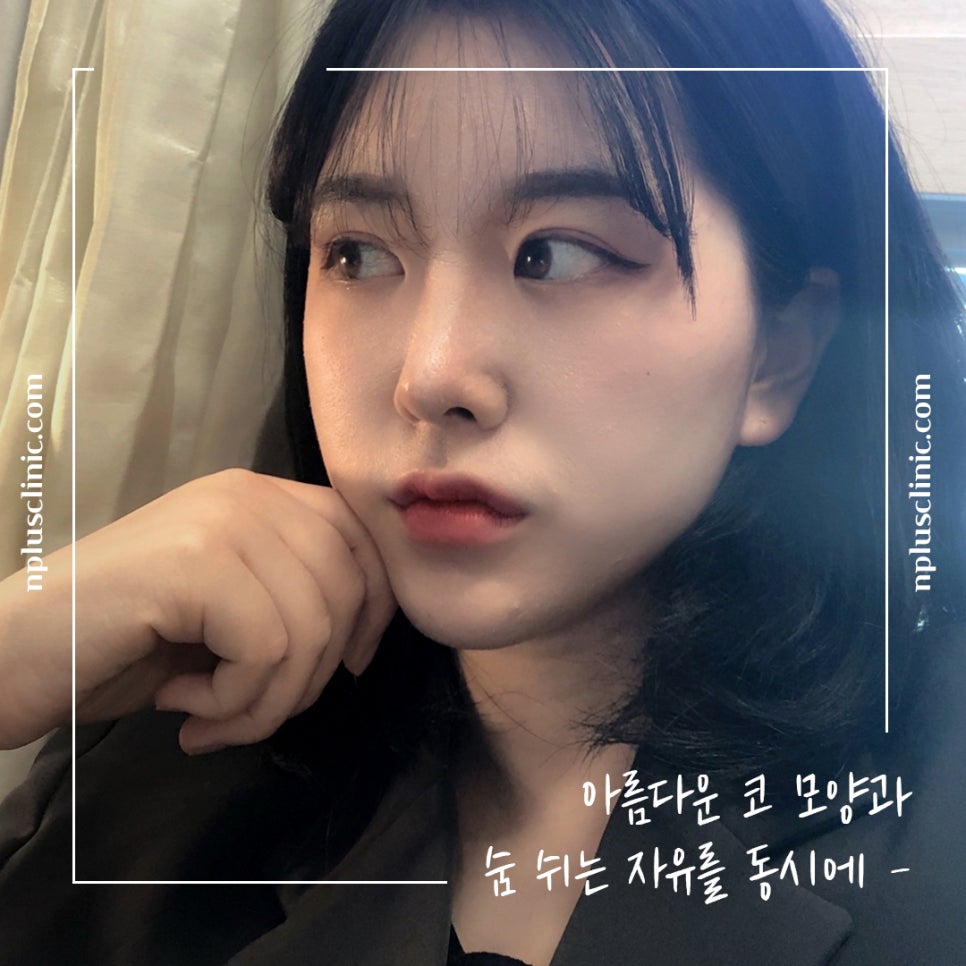 코수술전후 확실한 변화로 관련 이미지 1