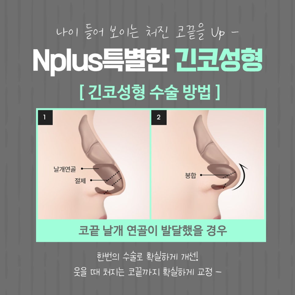긴코수술 후기까지 확인하고 선택 관련 이미지 11