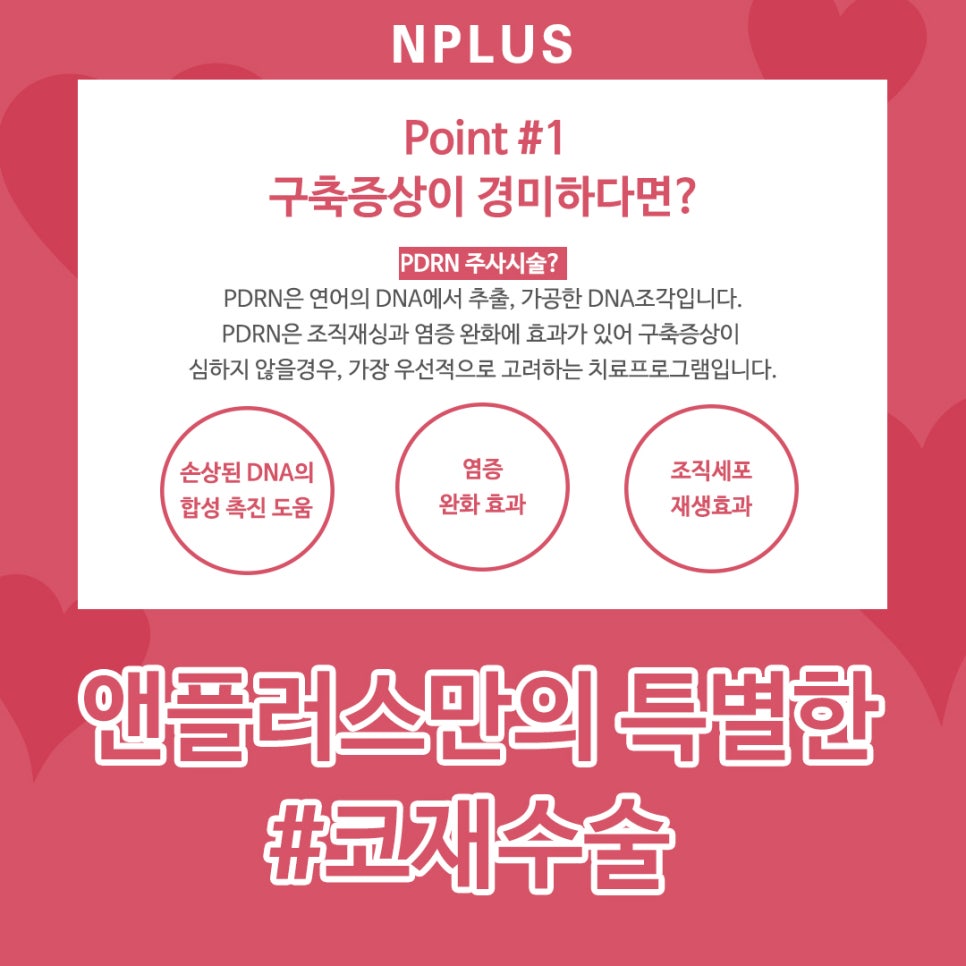 압구정성형외과_코재수술 본인 얼굴에 맞게 선택 관련 이미지 5