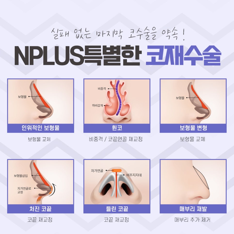코재수술 후기까지 확실하게 관련 이미지 9