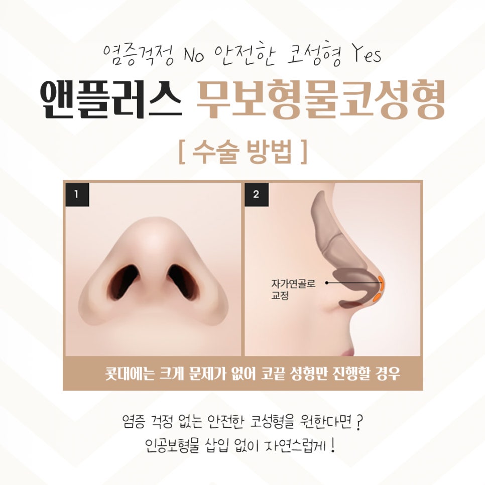 If You’re Looking for Reviews of Non-Implant Nose Surgery image 8