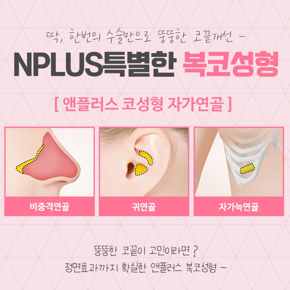 코지방제거를 통해 세련된 라인으로 관련 이미지 10