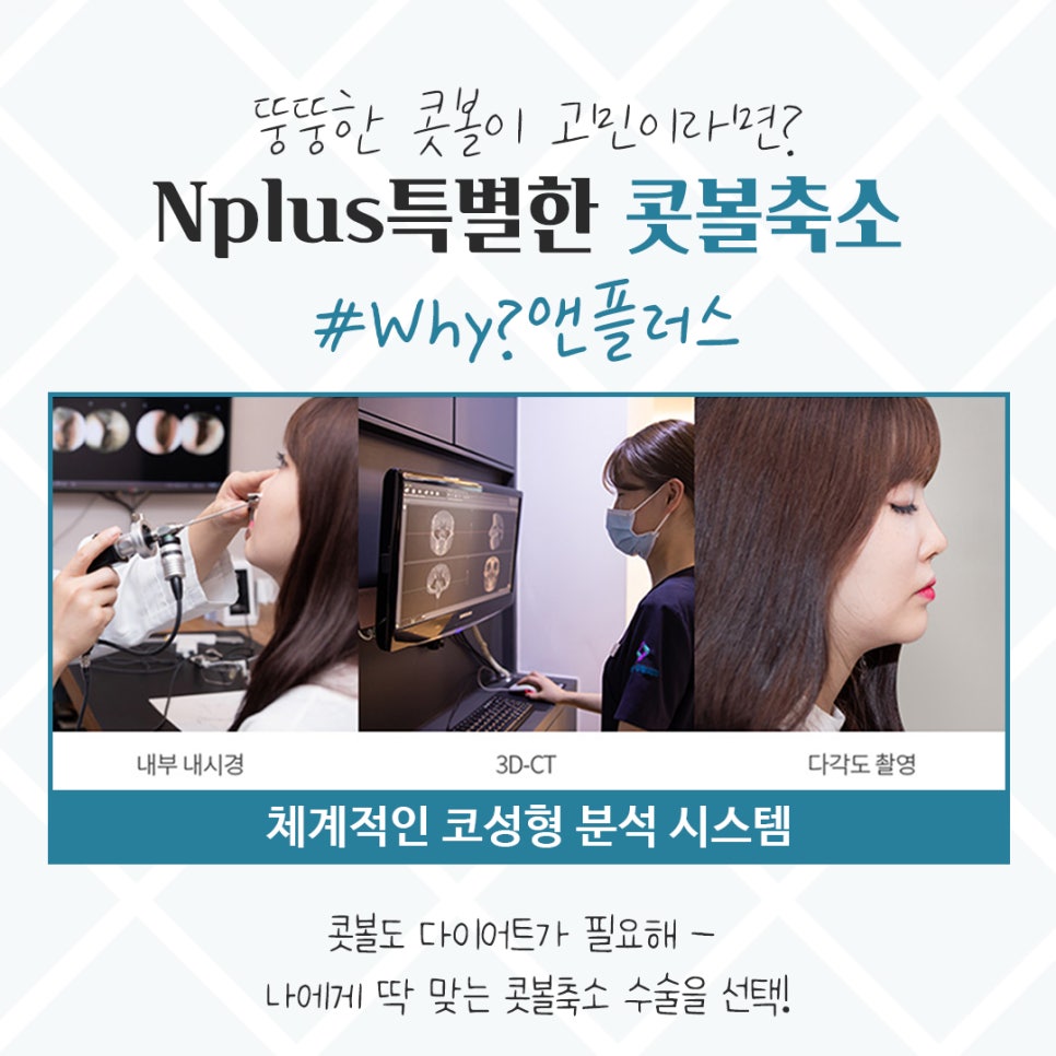 Choosing After Checking Rhinoplasty Alar Reduction Surgery Reviews image 5