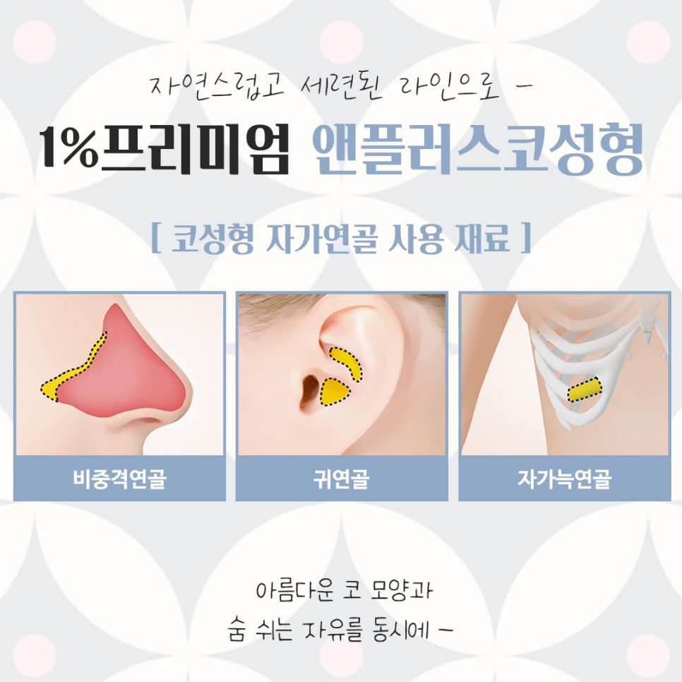 자가늑코성형에 대해 다양하게 알아보고 관련 이미지 4