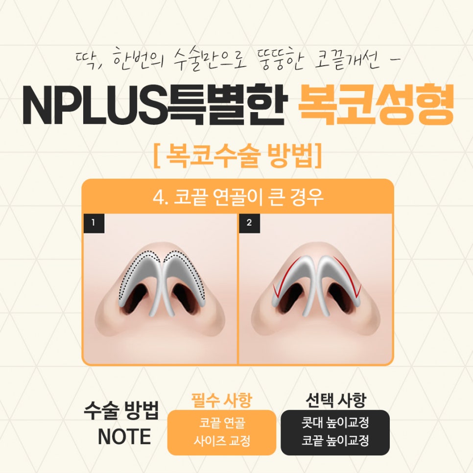 복코수술후기 정확한 진단을 통하여 관련 이미지 11