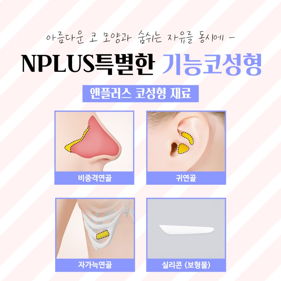 코수술후기에 대해 정확하게 진단하여 관련 이미지 8