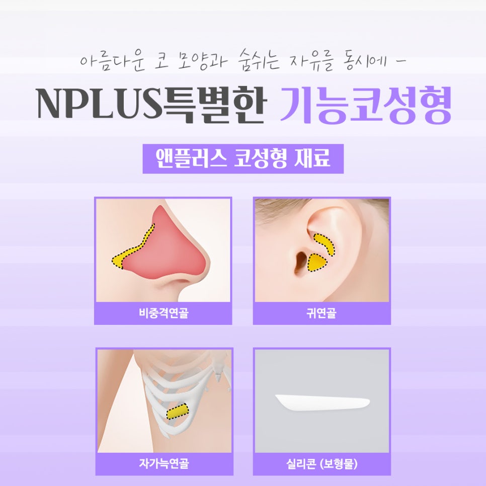 기능코성형후기에 대한 체크리스트 관련 이미지 11