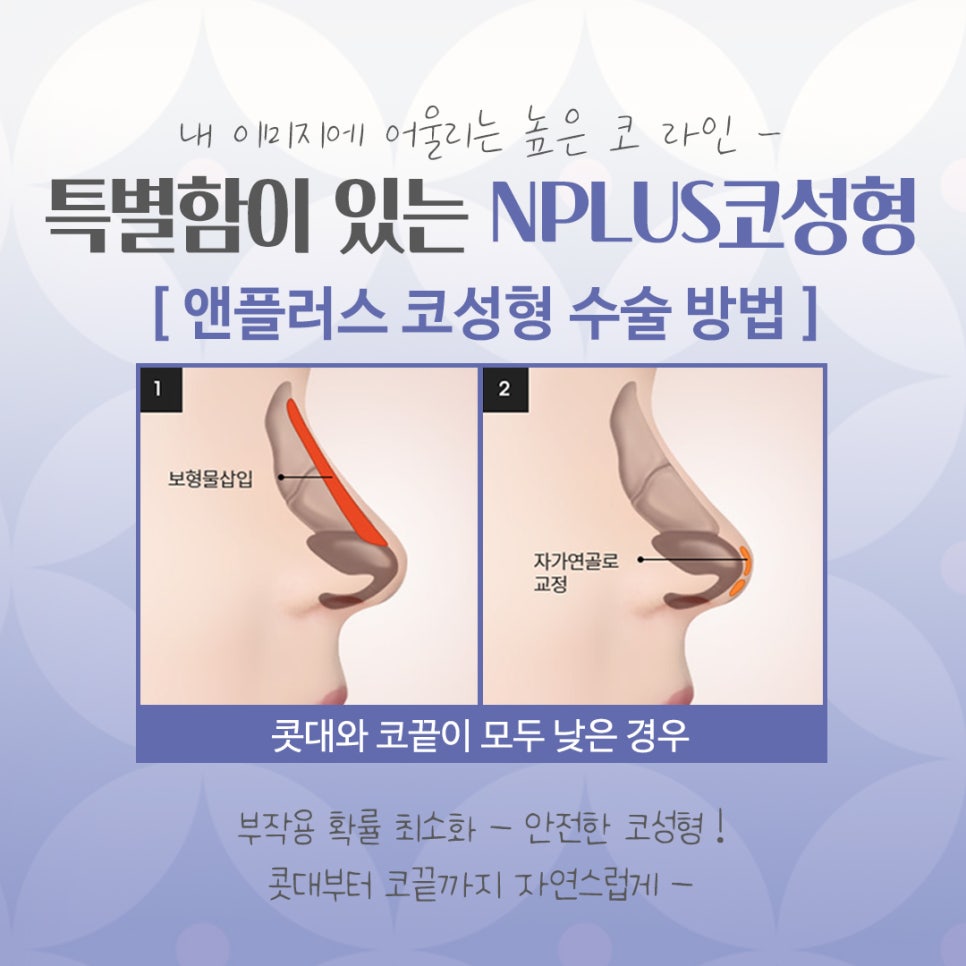 코수술잘하는곳에 대해 꼼꼼하게 체크하여 관련 이미지 8