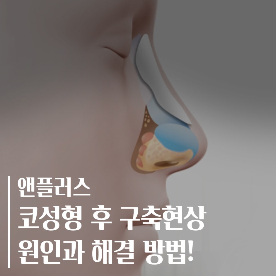 코구축현상이 일어나는 원인과 해결 방법 관련 이미지 1