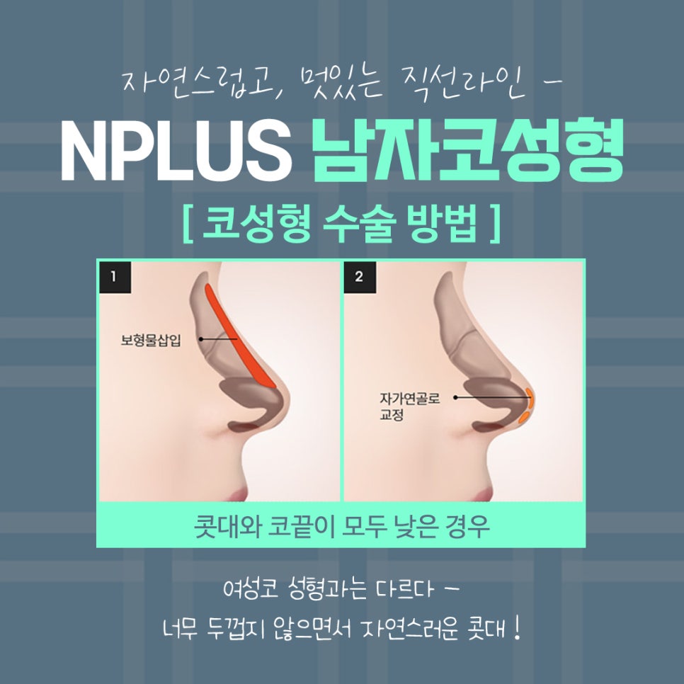 남자코수술전후 변화를 확인해 보고 관련 이미지 9
