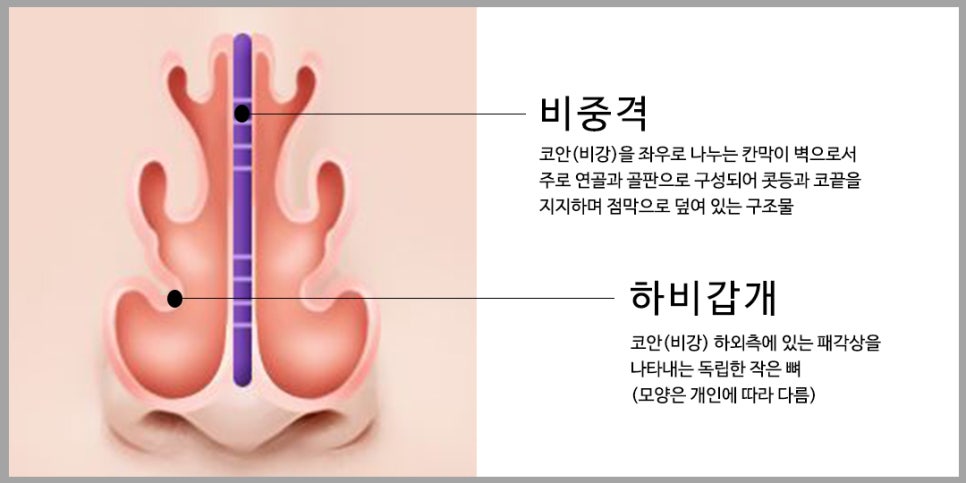비염코성형? 어렵지 않아요. 관련 이미지 3
