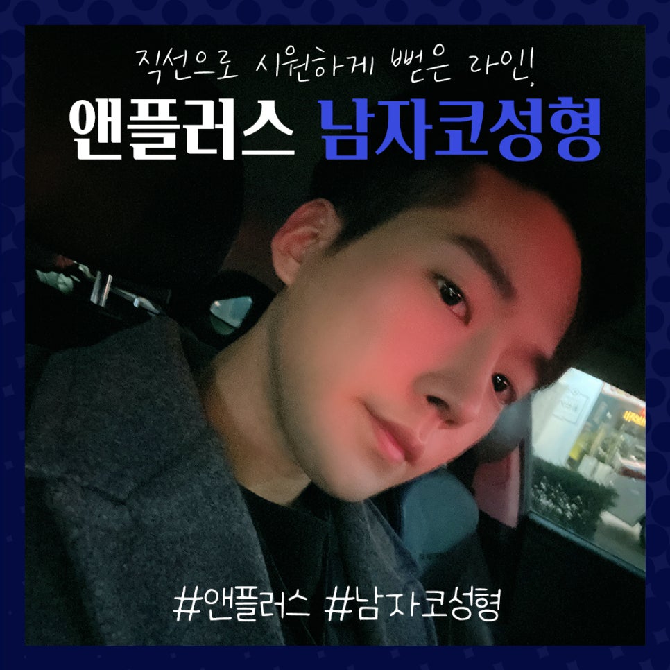 남자코성형전후 남자다운 직선라인으로 관련 이미지 2