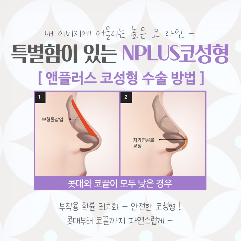 코수술잘하는곳 자세하게 알아보고 관련 이미지 8