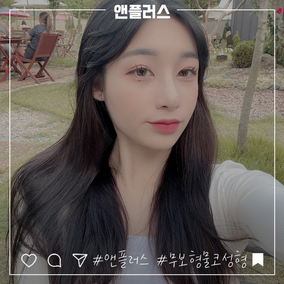 무보형물코수술에 대해 자세하게 알아보고 관련 이미지 2