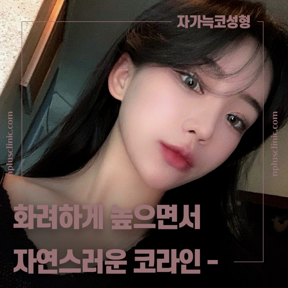 🍁가을엔 앤플러스의원 코성형 이벤트🍁 관련 이미지 10