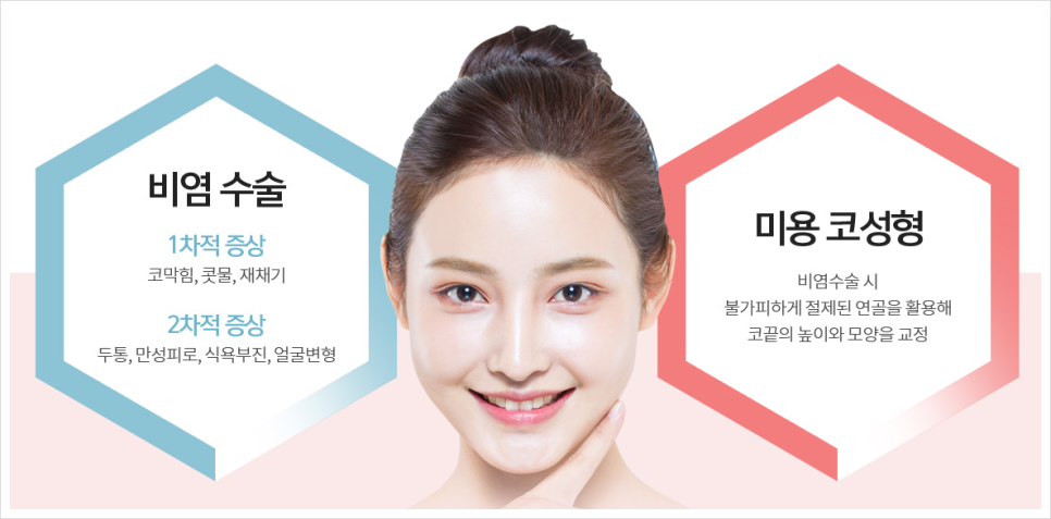 기능코성형 실비 어떤 경우에 받을 수 있는지? 관련 이미지 2