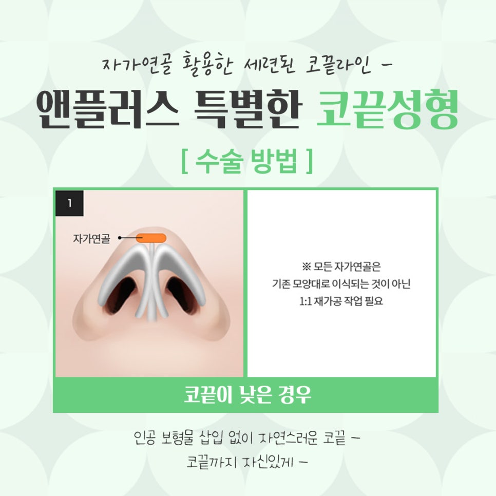 코끝수술후기 자가연골을 통해 자연스럽게 관련 이미지 6