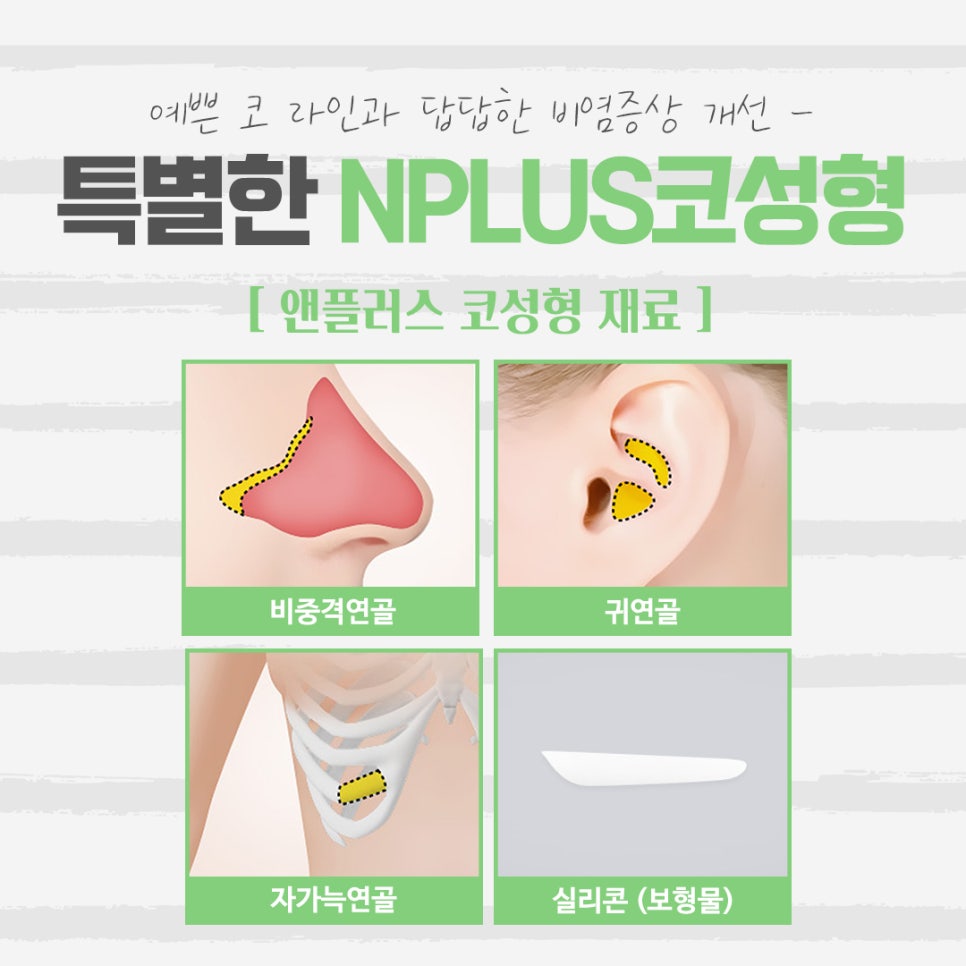 낮은코성형 후기에 대해 알아보고 관련 이미지 9