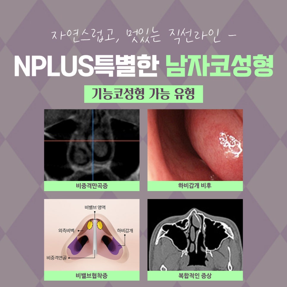 남자코성형후기 변화된 이미지를 확인 관련 이미지 5